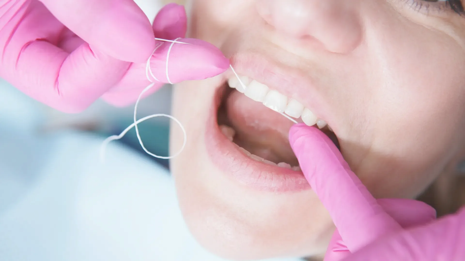 Professionelle Zahnreinigung bei DENTALEV – gesunde Zähne und strahlend weißes Lächeln